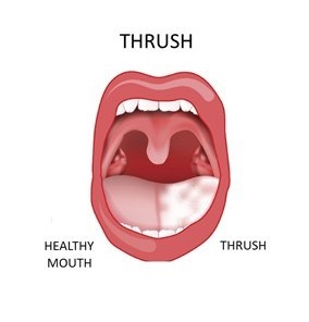 Diagram of the mouth showing the tonsils, hard and soft palates, uvula, tongue, gingiva, and vestibule.